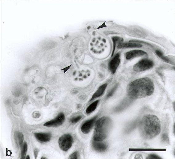 Chytridiomycosis2
